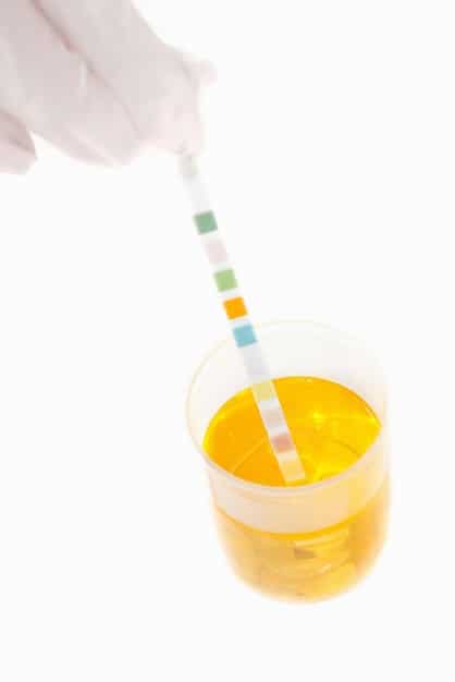 A close-up of a urine sample being tested in a veterinary lab. The focus is on the test strips and the color changes indicating certain compounds in the urine.